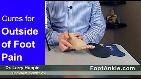 How to Treat Pain on the Outside of the Foot with Seattle Podiatrist Dr. Larry Huppin - YouTube