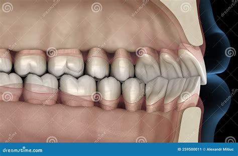 Healthy Human Teeth with Normal Occlusion, 3D Illustration Stock ...