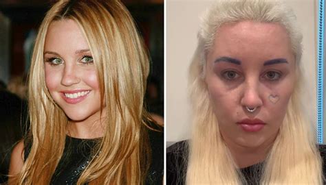 Amanda Bynes reveals she had bleph surgery to fix issues on her face | Newshub