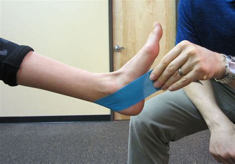 Taping for Posterior Tibialis Tendon Dysfunction (PTTD) - foppa.casa