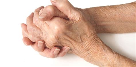 8 Warning Signs of Rheumatoid Arthritis - ArthritisLiving.today