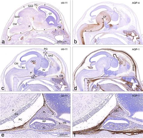 Immunocytochemistry of the leptomeninges in the developing rat brain at... | Download Scientific ...