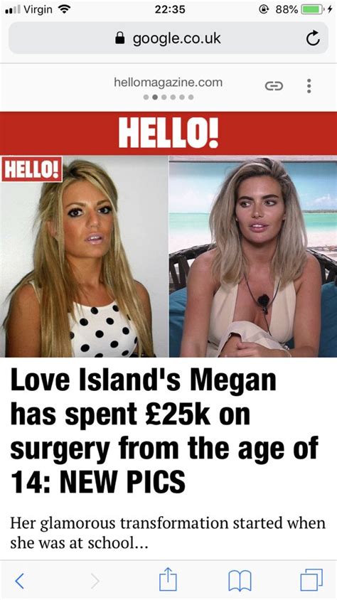 Megan Love Island Before Surgery - Smithcoreview