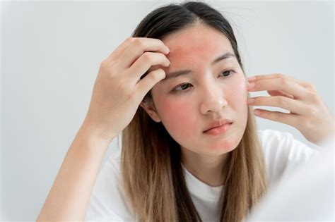 Premium Photo | Woman worried about face Dermatology rosacea dermatitis allergic steroids ...