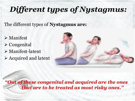 Nystagmus- Symptoms, Causes & Treatment Options Explained