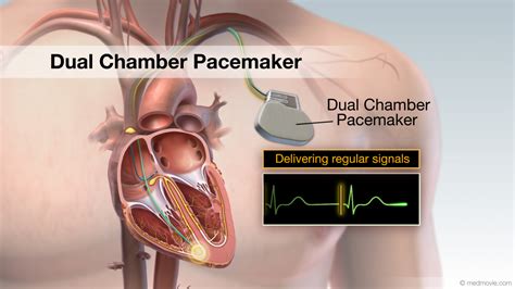 Cardiovascular Video Library