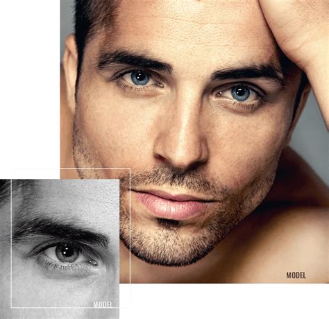 Male Blepharoplasty | Leyngold Institute for Plastic Surgery