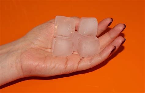 Ice Burn: Causes, Symptoms, And Treatment