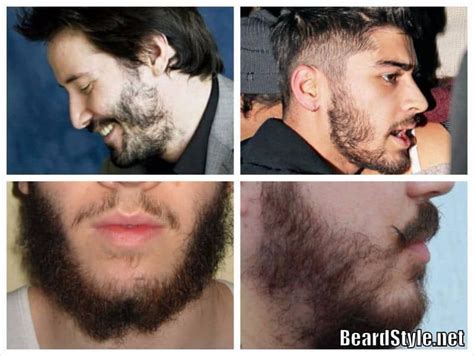 The Patchy Beards