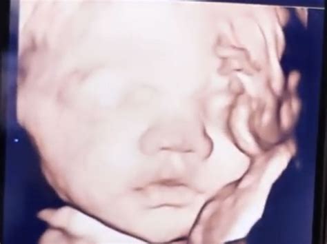 Pin de Sweetpeasjb en 4d ultrasound of the twins