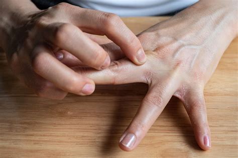 Itchy Fingers: Causes and Treatment