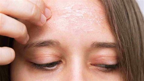 try these 5 effective home remedies for skin itching and dryness - त्वचा में खुजली और ड्राईनेस ...