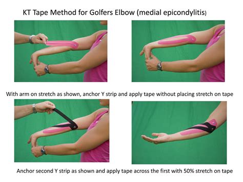 KT Tape for Golfer elbow | KT Tape | Flickr