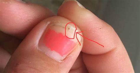 This Mom's Viral Photo About 'Seed Ticks' Is Important for All Parents to See - Mommyish