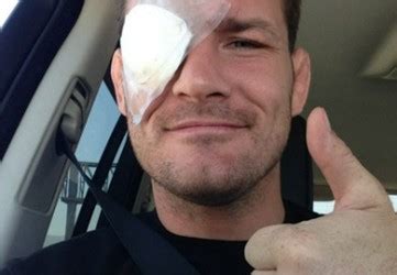 Michael Bisping Eyes Bout with Cung Le After Eye Heals | BJPenn.com