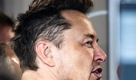 How did Elon Musk grow his hair back? - Natural Hair Turkey