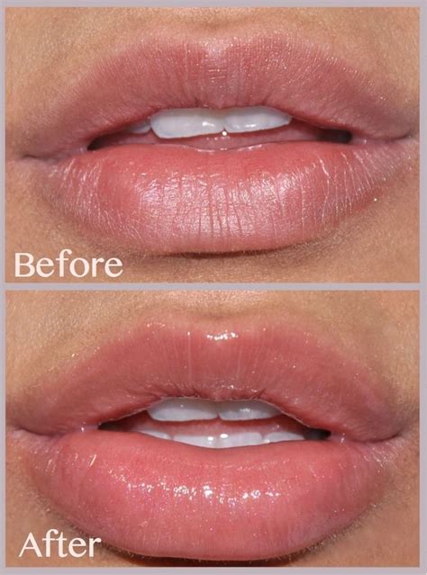 lip plumper effects | Diy lip plumper, Lip plumper, Plumping lip gloss