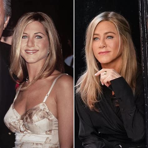 Jennifer Aniston Has Been Open About Her Plastic Surgery — Learn What Procedures She’s Had