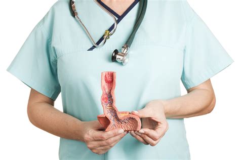 Treating Achalasia: How A Heller Myotomy Works — Tampa Bay Reflux Center