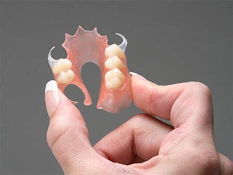 Flexible Dentures | sMiles Better Manchester