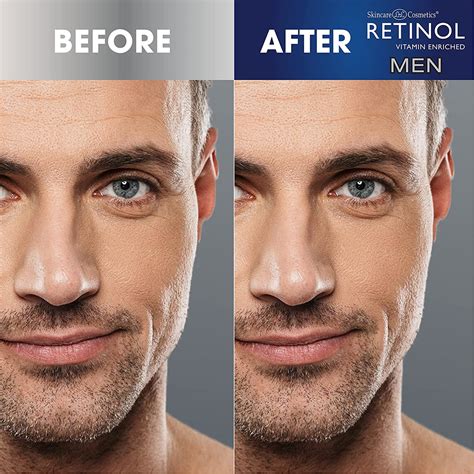 Men's Facial Serum – Retinol Treatment