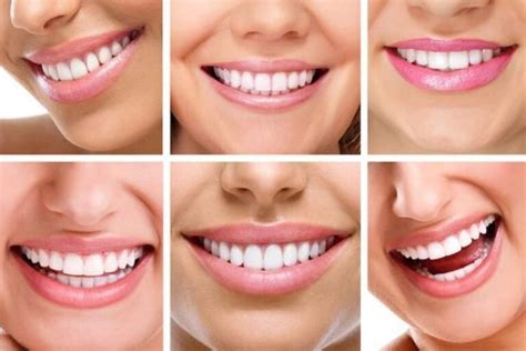 Types of Smiles: What Does Your Smile Say About You?