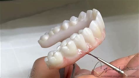 Implant Bridges Zirconia Monolithic Double Full Arch Tutorial - YouTube