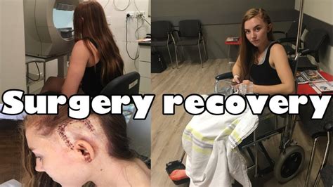 How I recovered after brain surgery | 3 month process - YouTube