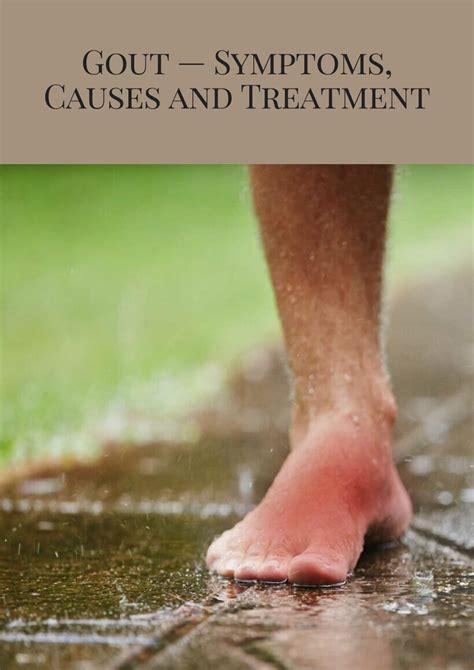 Gout Symptoms Causes And Treatment By Aisha Kapoor Issuu - Vrogue