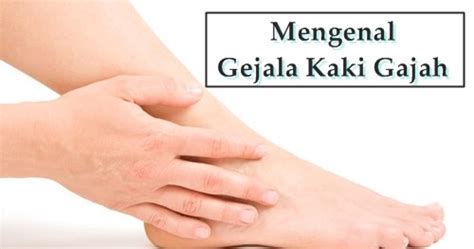 Mengenal Gejala Kaki Gajah Yang Harus Diwaspadai Sejak Dini - PUSAT PENGOBATAN ALAMI