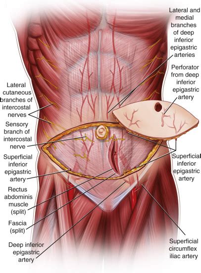 Inferior Epigastric Artery