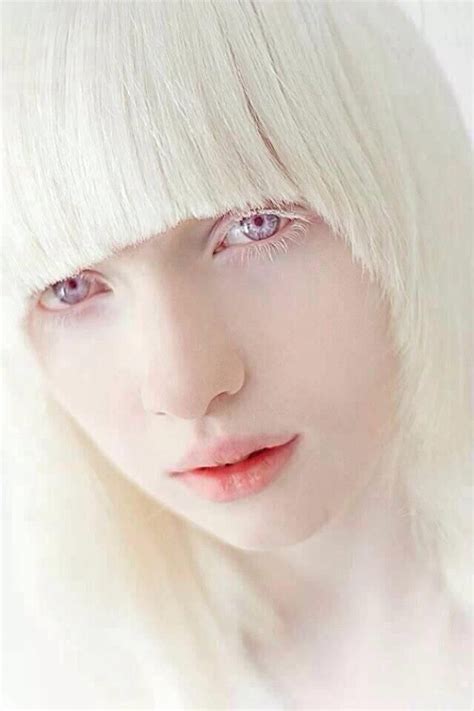 From Russia's 16-year-old suffering from albinism model Nas ... | Augen ...