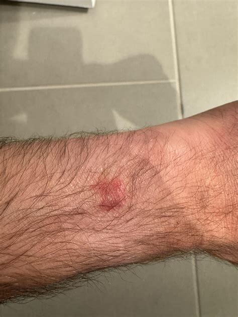 “Burn” marks directly under sensors? : r/AppleWatch