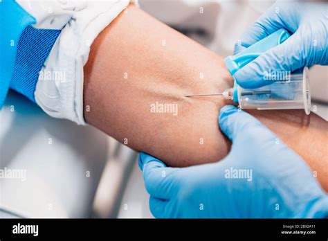 Close up needle in vein - blood draw - blood donation - blood transfusion Stock Photo - Alamy