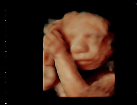 How will your baby look in a 3D ultrasound?