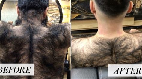 This Man's Back Hair Transformation Is Going Viral on Instagram | Allure