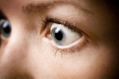 Bulging Eyes (Exophthalmos or Proptosis): Causes & Treatment | MyVision.org