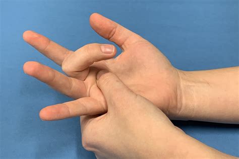 Is trigger thumb common in children? – Hand Therapy Group