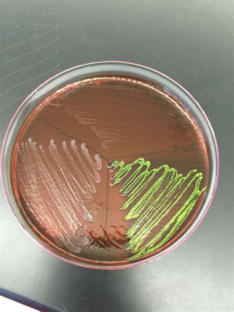 EMB AGAR PLATE | Microbiología, Bioquímica, Farmacia