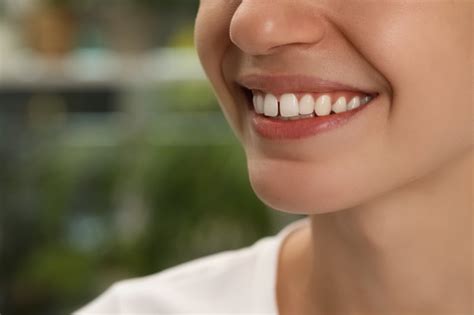 How Do You Fix a Gap Between Front Teeth? | Fort Dental