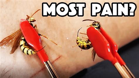 HORNET STING Vs WASP STING! Which hurt WORST?!