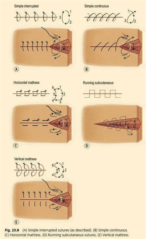 Pin by Matthew Brown on Survival | Vet medicine, Medical education ...