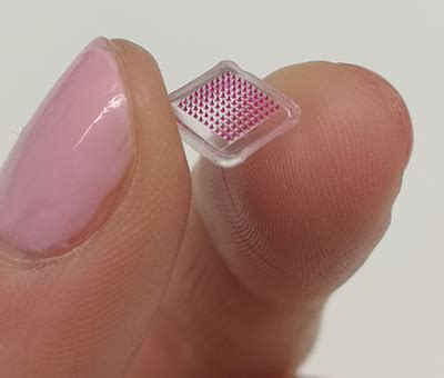 Microneedle patch delivers antibiotics locally in the skin