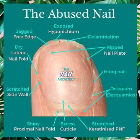 Repairing Abused Nails – The Nail Architect