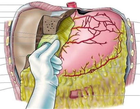 Epiploic Foramen 2 Anatomy And Physiology, Human Anatomy, Liver, Nursing, Lunch Box, Medical ...