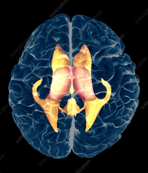 Ventricles of brain, MRI - Stock Image - P332/0376 - Science Photo Library