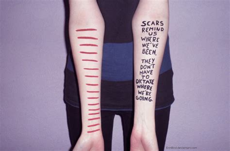 We All Have Scars Quotes. QuotesGram