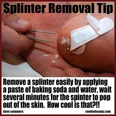 removing splinters - this actually works, just tried it with a deep splinter and after 5 minutes ...