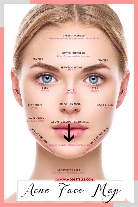 Face mapping acne chinese causes and remedies of acne – Artofit