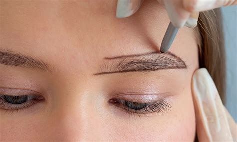 Eyebrow Transplant - VeraClinic